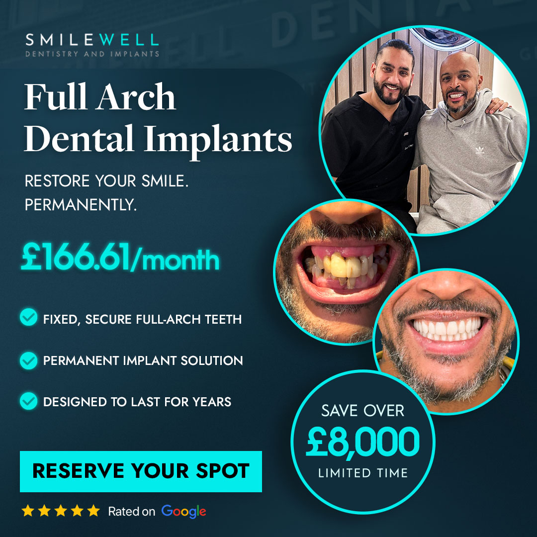 Smilewell Dental full arch implants advertised offer