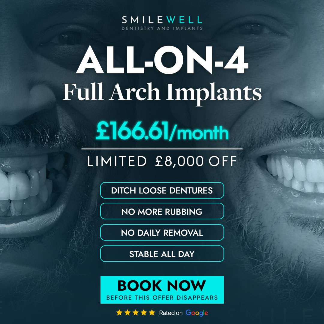 Smilewell Dental full arch implants advertised offer