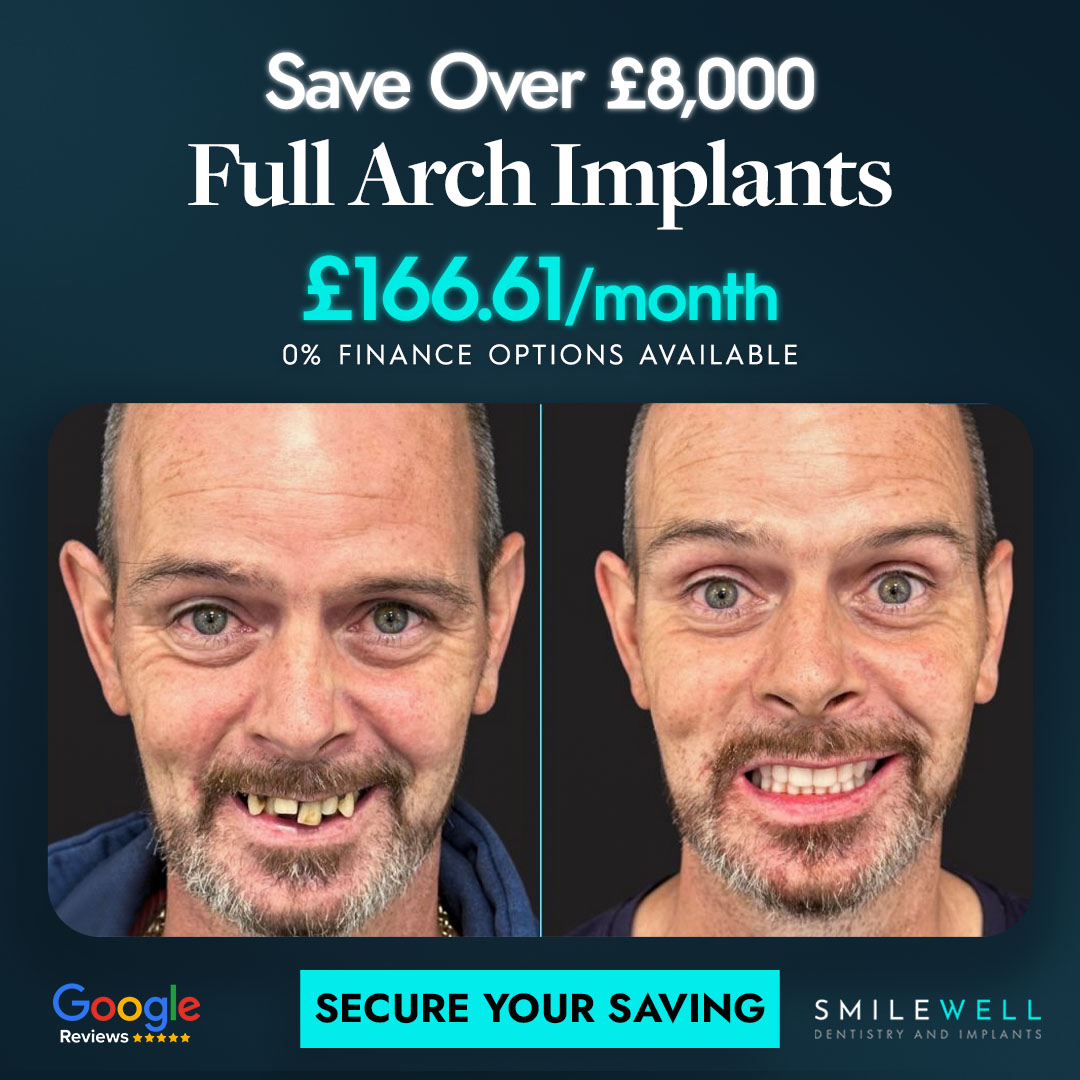 Smilewell Dental full arch implants advertised offer